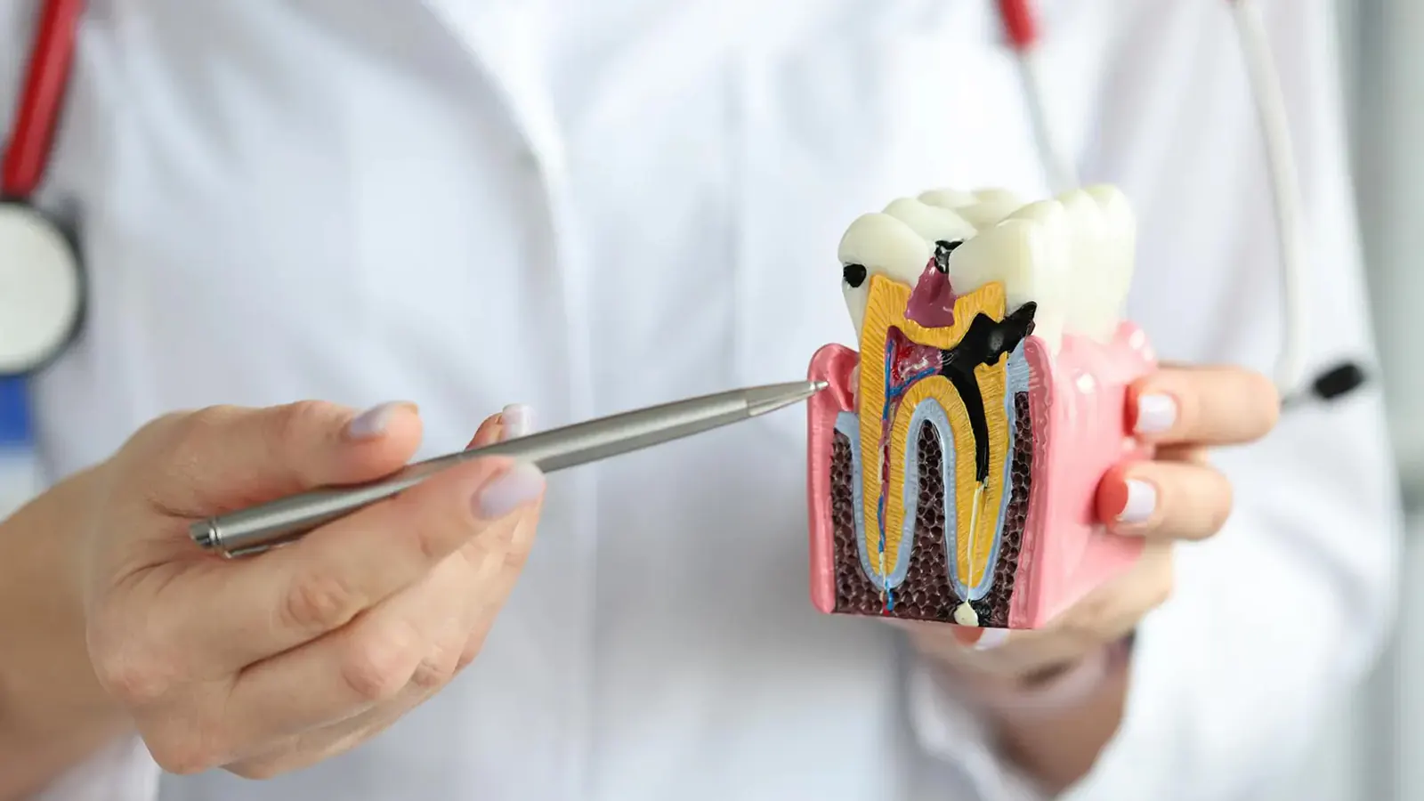 Endodontics