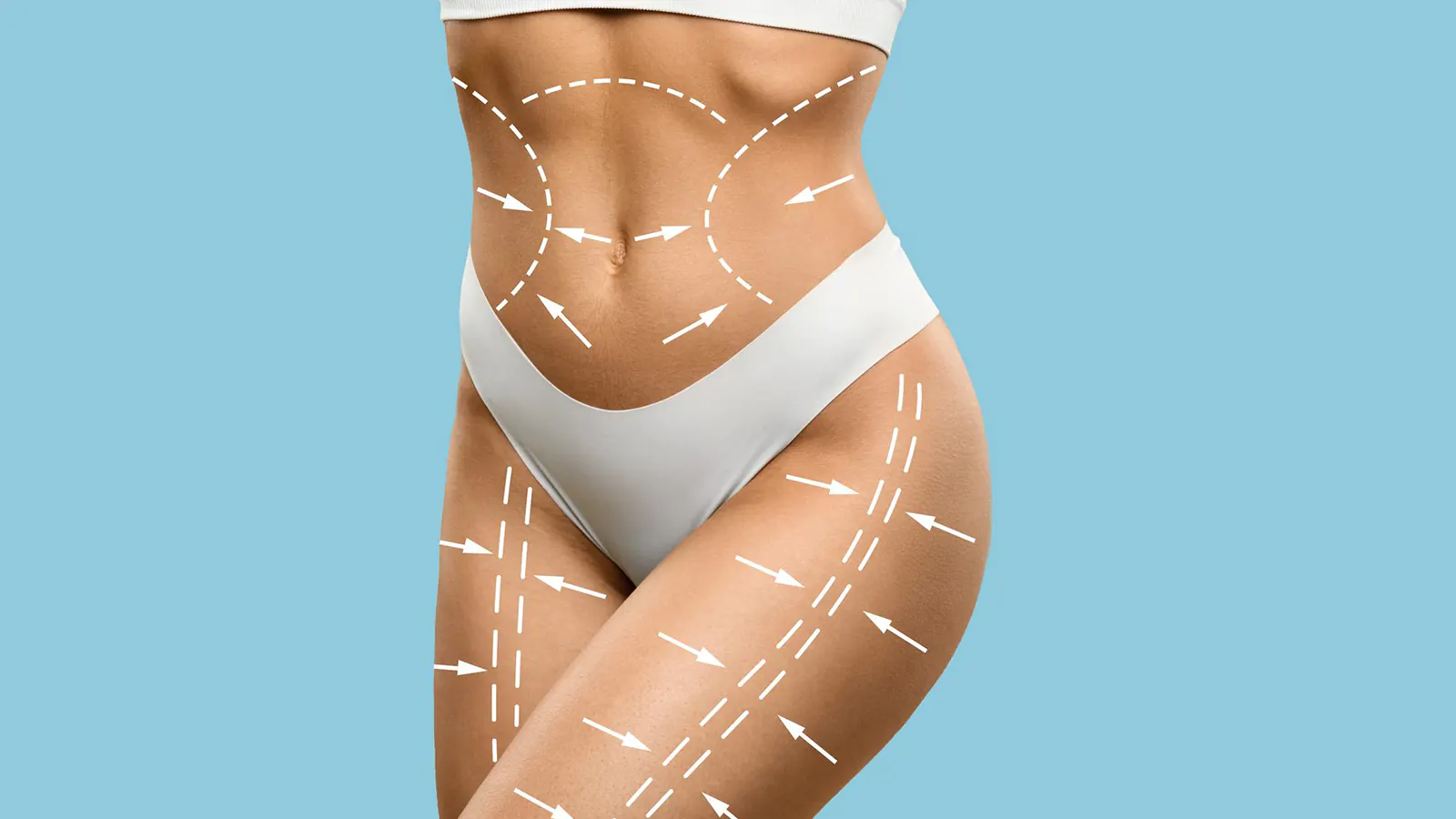 Body Contouring