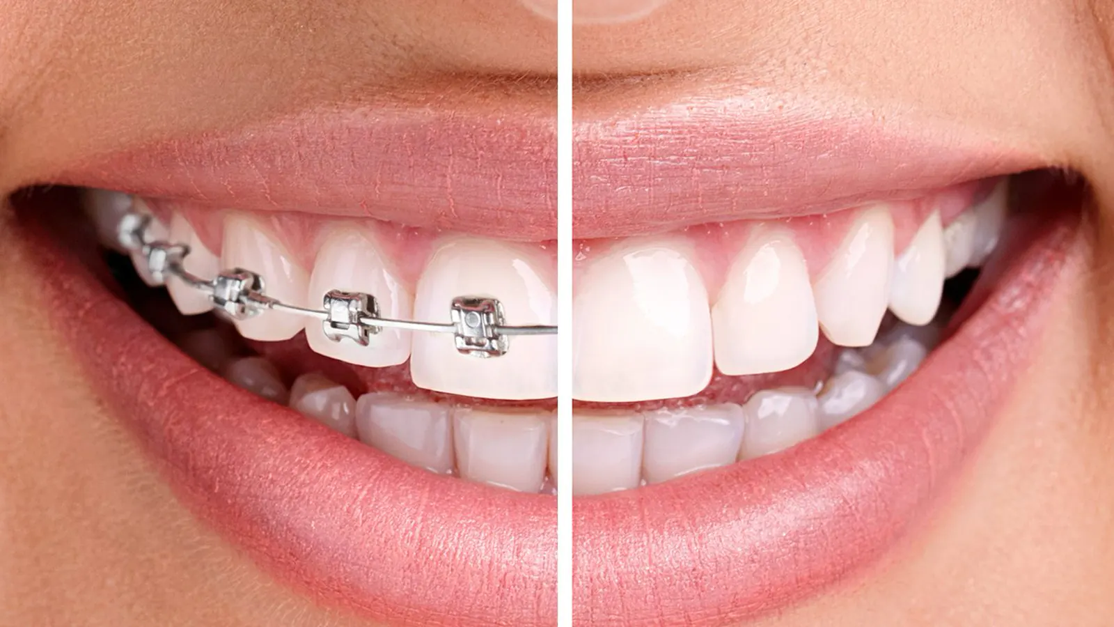 Orthodontics