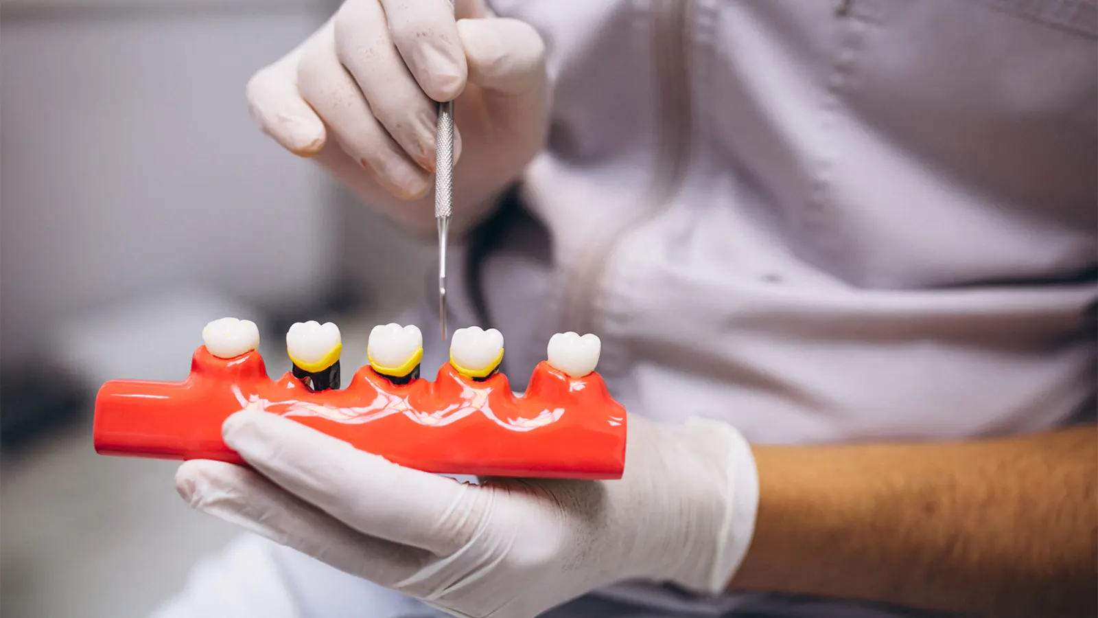 Implant Dentistry