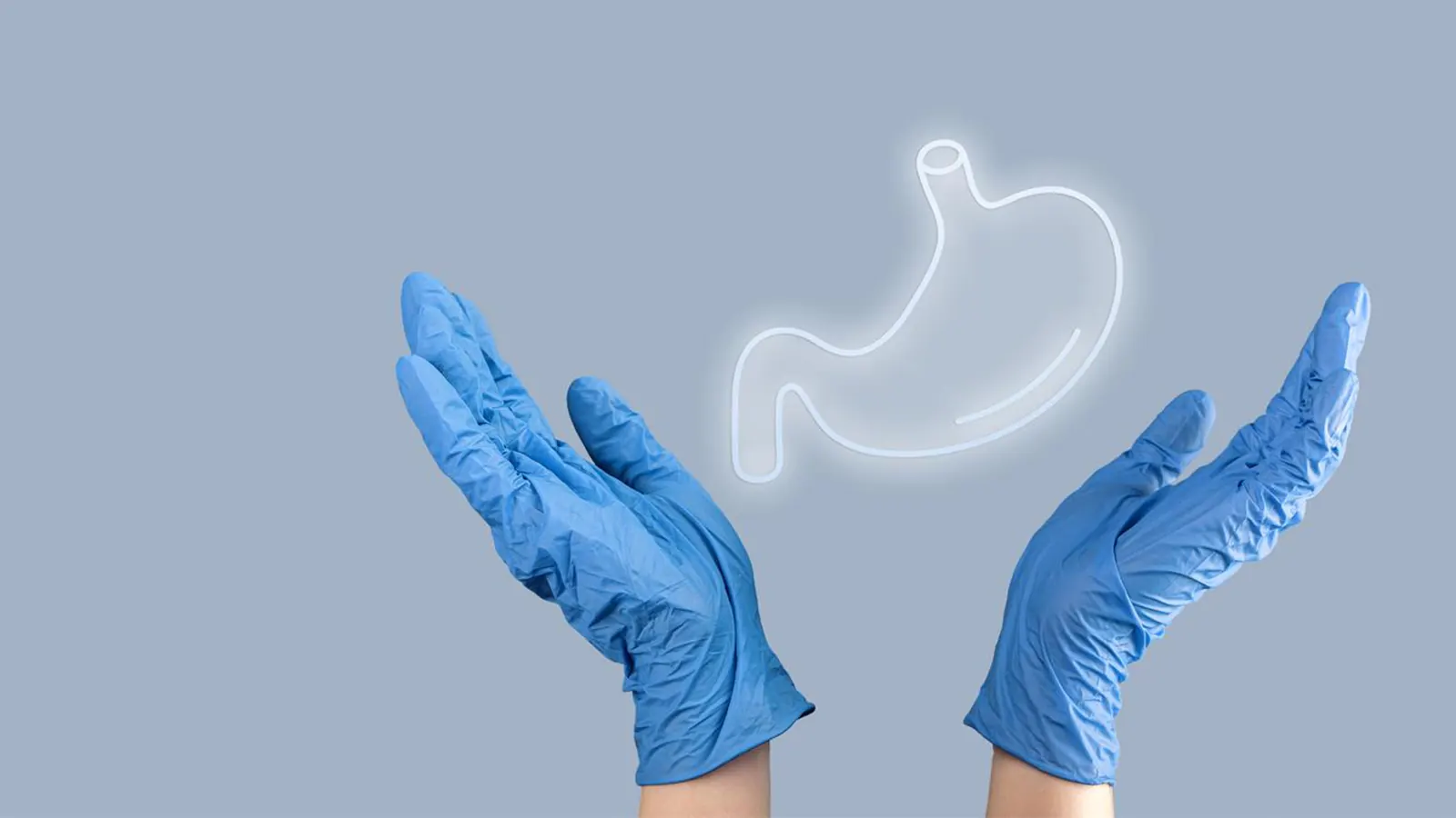 Sleeve Gastrectomy
