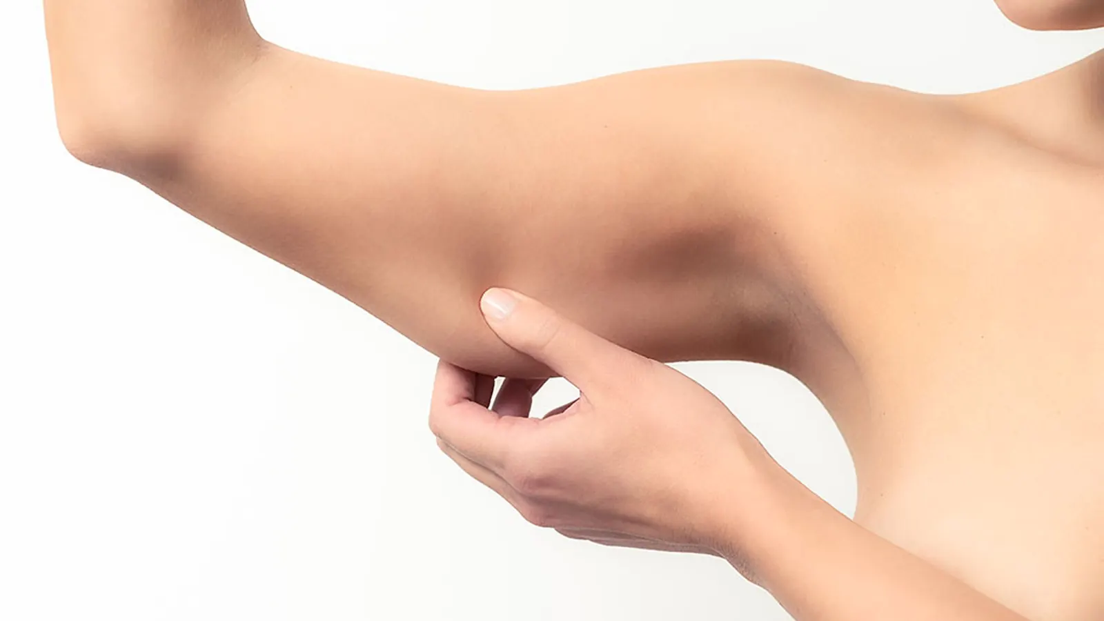 Arm Lift
