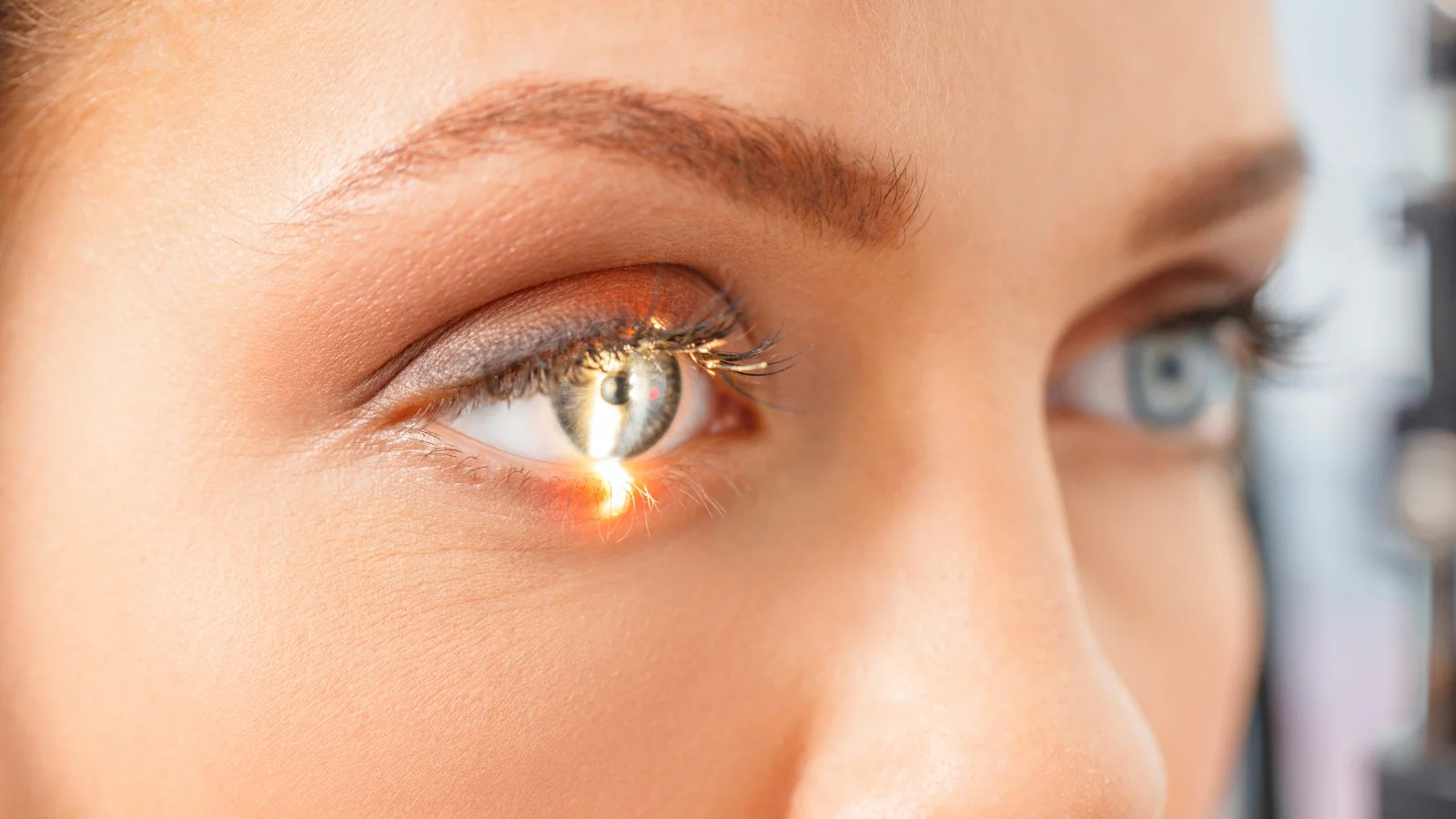 Lasik Eye Surgery