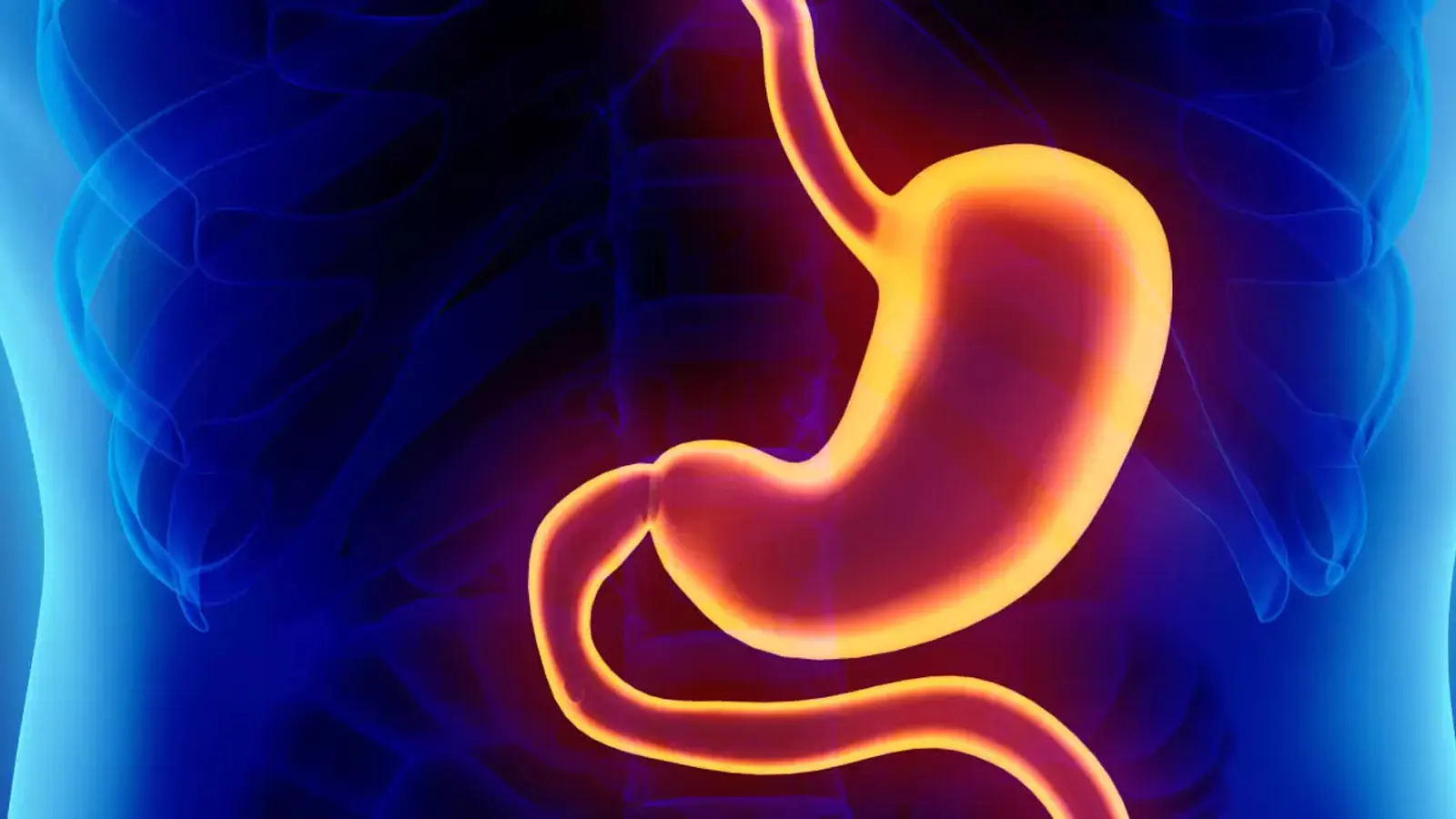 Gastric Plication